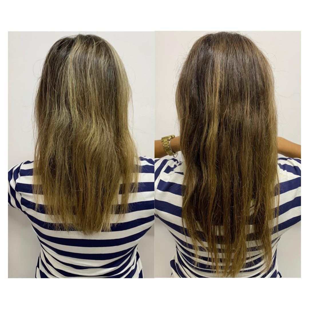 Antes e depois - protocolo capilar frontal